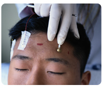 Electroencephalograms EEG